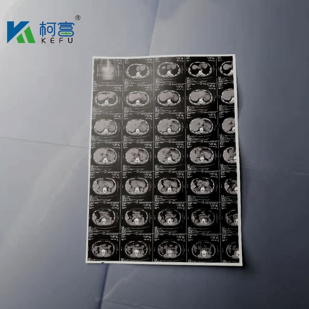 Radiology film x-ray medical x-ray white film for image printing