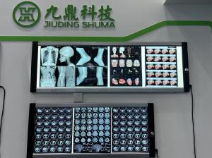 Quality Printing Blue Thermal X Ray Laser Film Medical X Ray Equipments wholesale