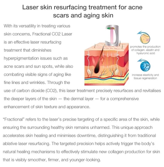 RF Fractional CO2 Laser For Stretch Marks Scar Removal Vaginal Tightening Machine