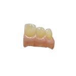 Yellow Dental Ceramic Glaze Porcelain Powder CE For Ceramic Glazing