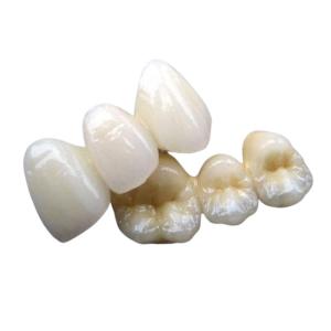 Quality Porcelain Bridge Crown Tooth Strong Stability None Foreign Body Sensation wholesale