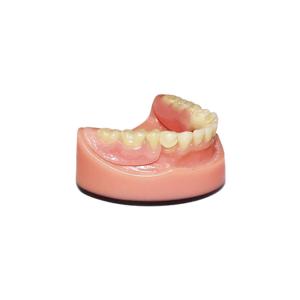 Quality OEM PFM Dental Bridge 3D Digital Intraoral Scanning Imaging System wholesale