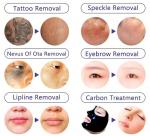 Portable Pico Second Laser Tatoo Remover Q Switched Nd Yag Picosecond Tattoo