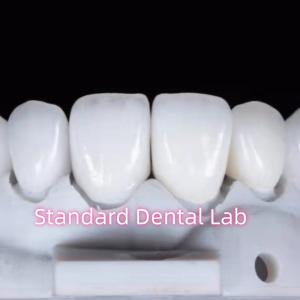Quality Natural Looking Restorations Aidite Dental Zirconia Tooth Crown wholesale