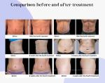 600w 5 Handles EMS Sculpting Machine For Neo RF 14 Tesla Bodi Sculpting Body