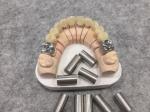 Eco Friendly Base Metal Alloys In Dentistry , Copper Cobalt Alloy No Beryllium