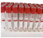 Serum Plasma Blood Sample Collection Tubes Pollution Free Eco Friendly