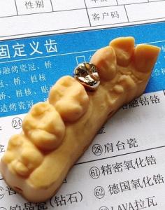 Quality Good Fitness High Precious Gold Alloy Dental Crown wholesale