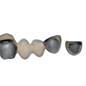 Quality Natural Cobalt Chrome Alloy Porcelain Teeth Super Corrosion Resistant wholesale