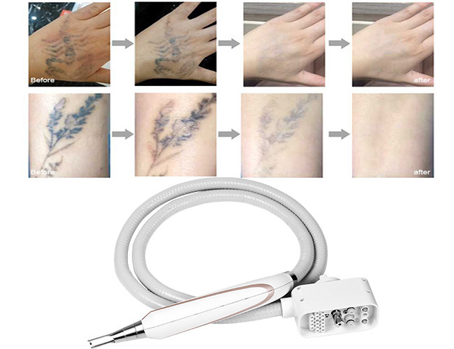1064Nm 1320Nm 532nm Whitening ND YAG Laser Machine