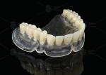 Heat Curing Vertex Thermosens Dentures For Clear Full Denture Wearers