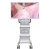 Buy cheap Medical Endoscope Monitor Camera With Screen 55inch from wholesalers