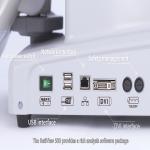 SD Optical Coherence Tomography Device For Corneal Disease