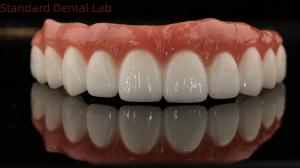 Quality High Quality Dental zirconia crown and All On Four Six Implant Full Arch / China dental lab Manufacturer wholesale