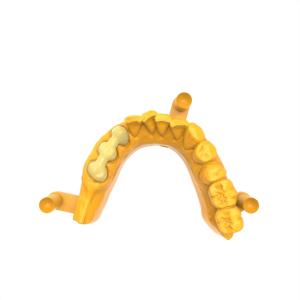 Quality 92 Shore Permanent Crown Bridge Resin with Breaking Elongation Rate of 5.5-7.3% wholesale