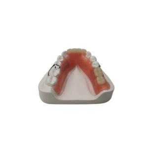 Quality Flexible Resin Denture Dental Lab Dental Acrylic Removable Partial Dentures wholesale