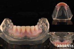 Quality Tooth Arrangement Technology Flexible Denture Finish High Elasticity Customization wholesale
