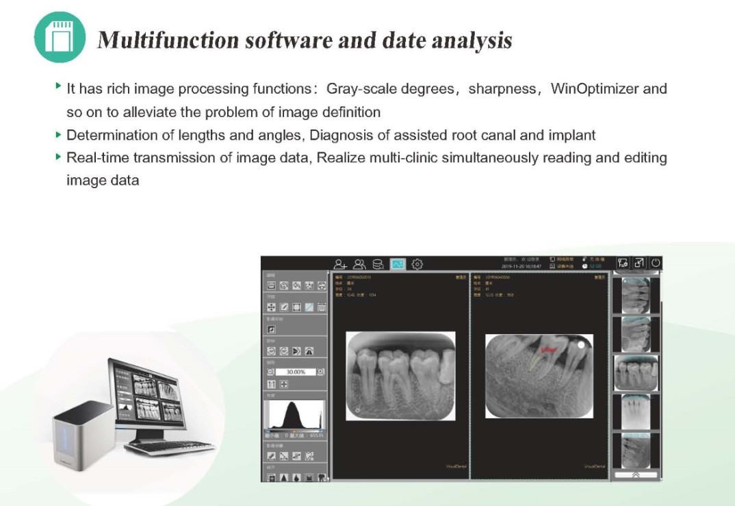 CR Imaging Plate Intraoral Dental X Ray Film Scanner