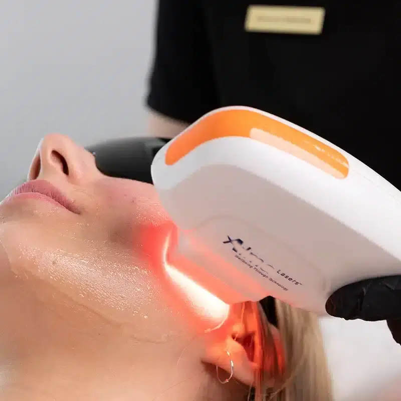 NIR Milk Light Whitening Beauty Equipment 3 Wavelength 755 808 1064 Permanent Painless 808 Diode Laser Machine Hair Removal Laser