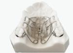 EN ISO 13485 2012 Orthodontic Accessories Metal Dental Hyrax Expansion Screw