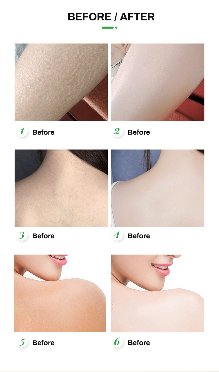 Whitening Moisture Body Lotion Nourish Dry Skin For Men And Women
