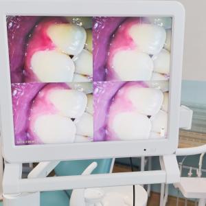 Quality Dental Endoscope With 17 Inch Monitor Wifi Handheld Portable Dental Camera Intraoral Endoscope Intra Oral Camera wholesale