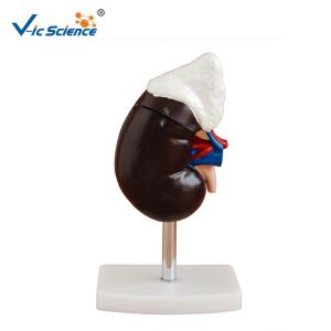 Quality Medical Human Kidney Model , Human Organ Model With Adrenal Gland wholesale