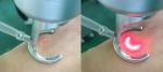 Stationary Fractional Laser Co2 Machine Scar Removal Infrared Skin