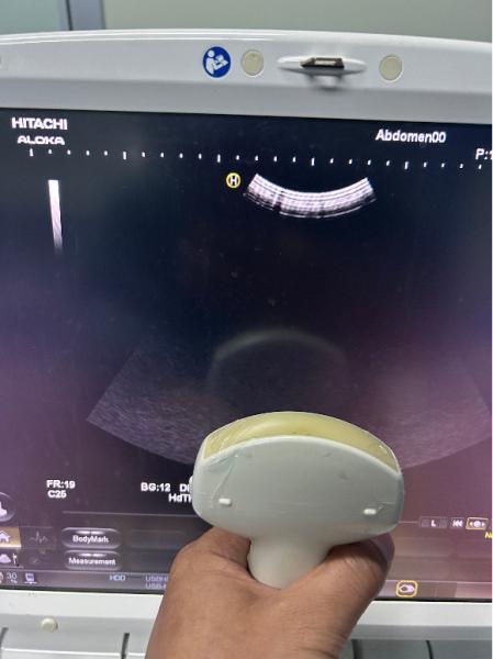 8MHz Ultrasound Repair Device Testing Diagnostics Hitachi Ultrasound Transducer