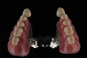 Quality Stain Odor Resistant Full Acrylic Denture Natural Looking Acrylic Resin Denture Teeth wholesale