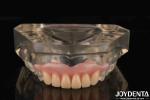 Tooth Arrangement Technology Flexible Denture Finish High Elasticity Customizati