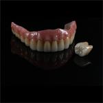 Personalized Strong Ceramic Zirconia Dental Crown Full Mouth Full Contour
