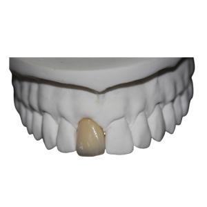 Quality Co Cr Porcelain Dental Crown wholesale