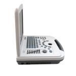ON SALE!!! Portable full digital laptop B&W ultrasound scanner for hospital