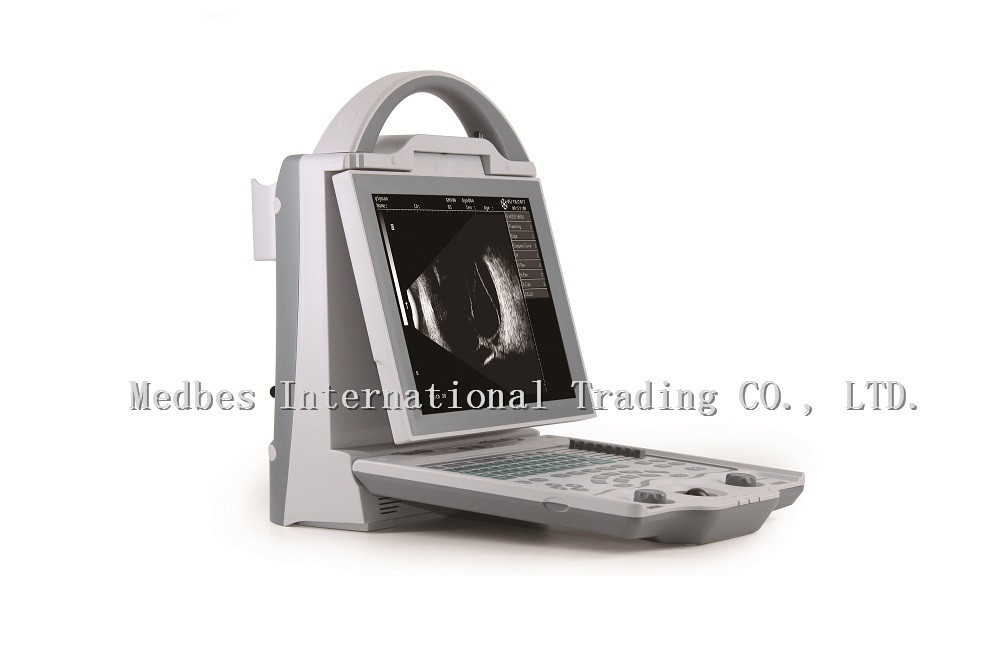 Full digital A/B scan portable cheapest Ophthalmic Ultrasound
