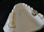 OEM Polishing Porcelain Dental Crown High Biological Intermiscibility