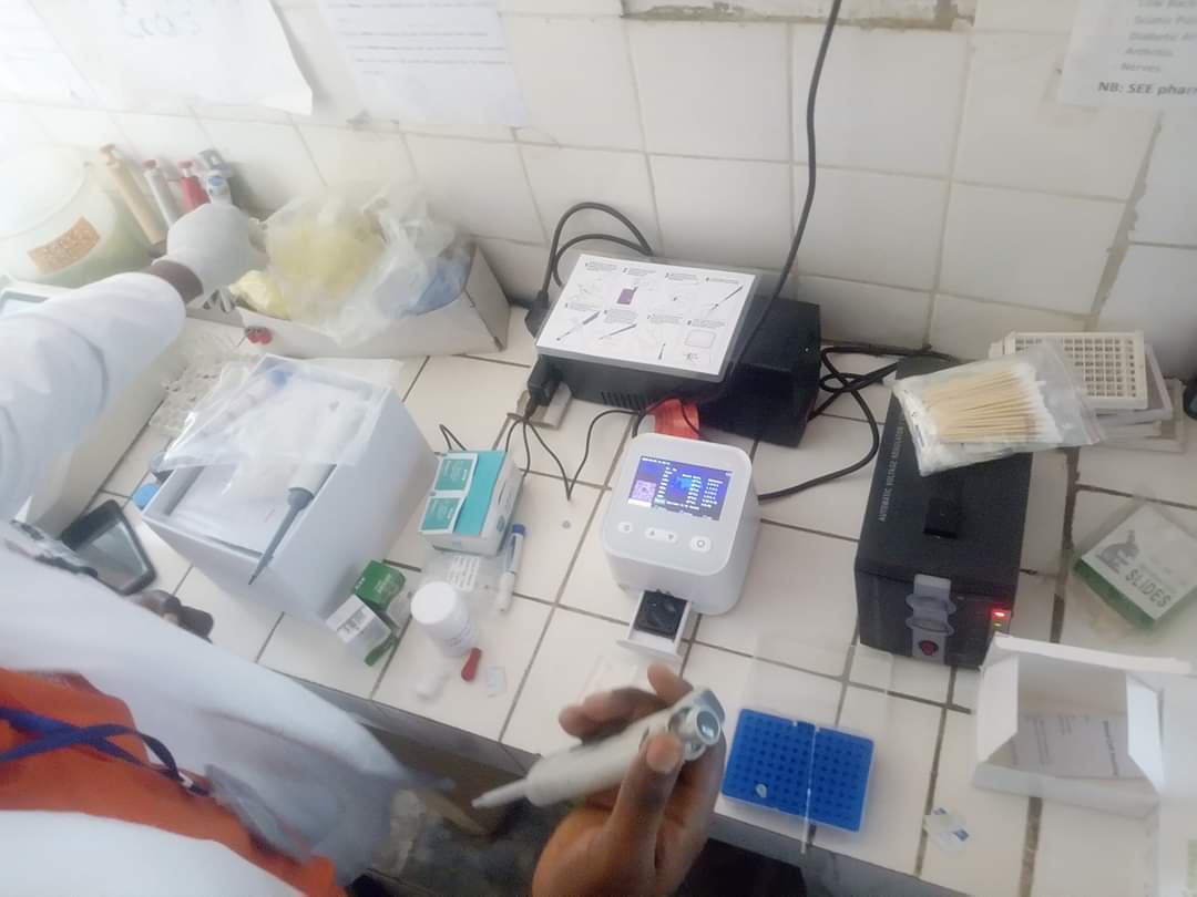 blood cell counter auto 5 parts CBC analyzer with microfluidics chips