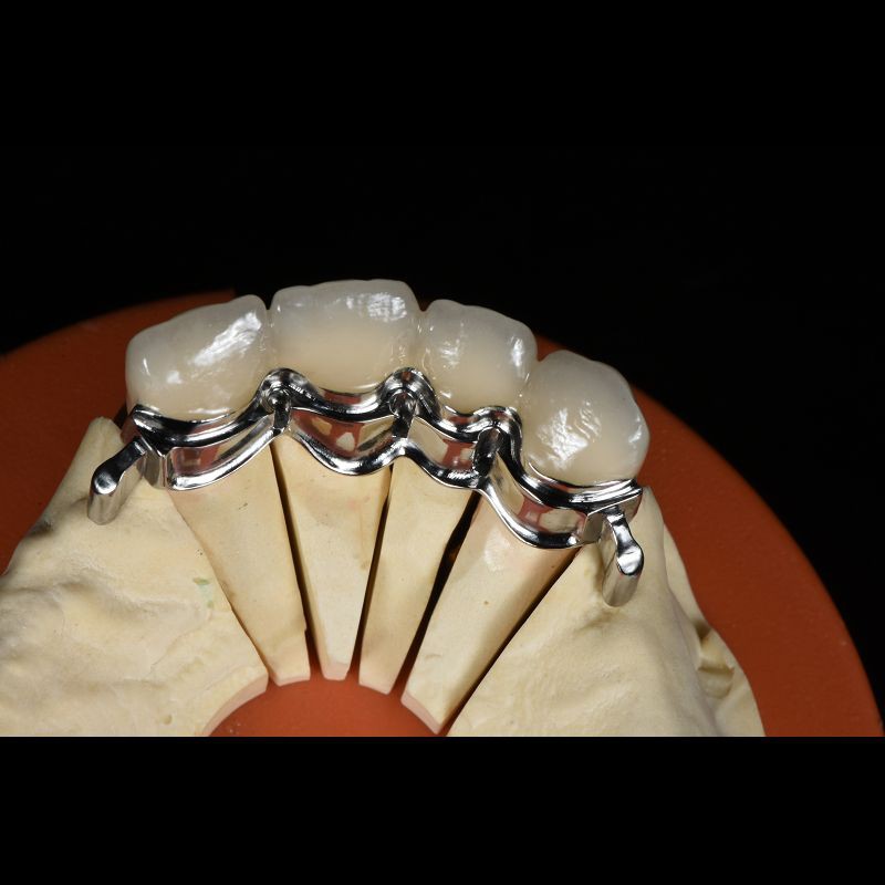 Precision Zirconia PFM Crowns Partial Dentures Natural Looking