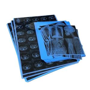 Quality 210um Waterproof Medical Dry Film Inkjet Printing Film 14x17 Inch wholesale