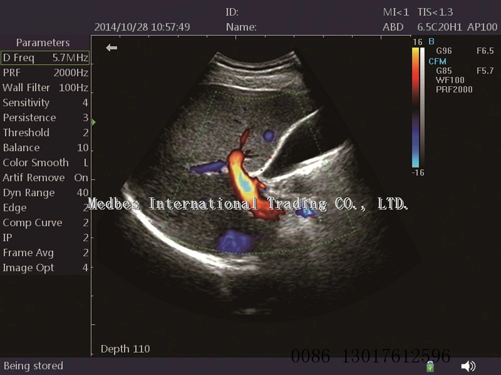 New Arrival Hospital 10.4 Inch Ultrasound echography