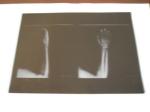 KND-A Low Fog Medical Dry Imaging Film For X Ray Examination On AGFA 5300 11in ×