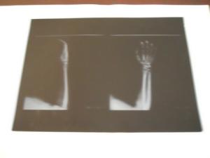Quality KND-A Low Fog Medical Dry Imaging Film For X Ray Examination On AGFA 5300 11in × 14in wholesale