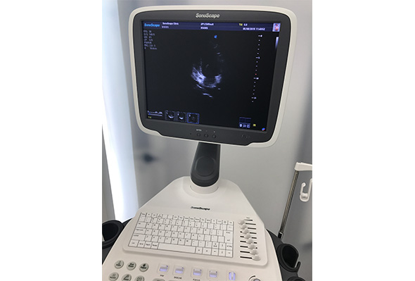 S12 Ultra Compact Medical Ultrasound Equipment ECG Module 12 Months Warranty
