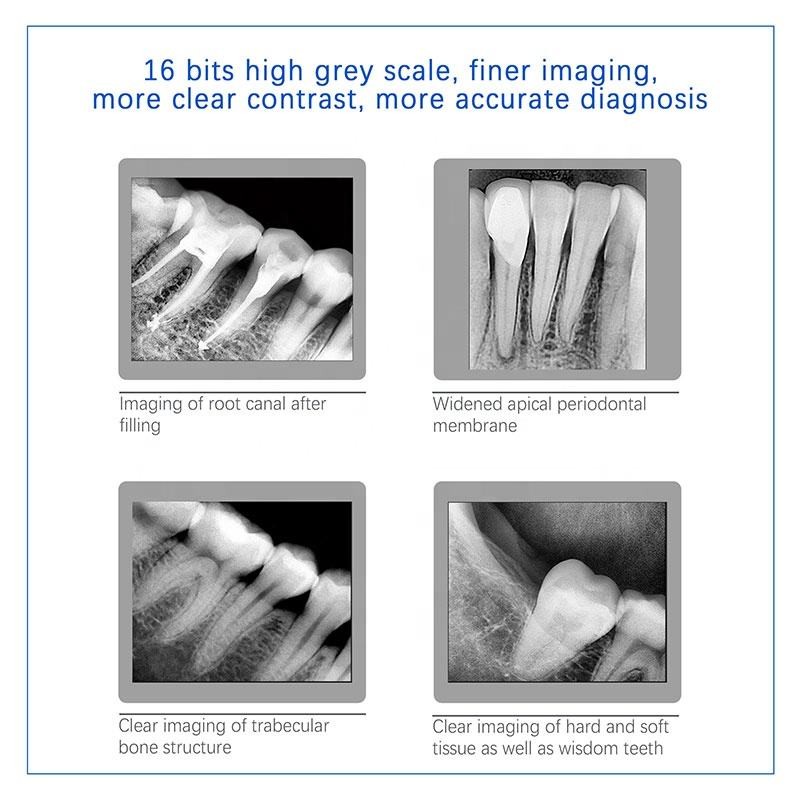 USB Multipurpose X Ray Dental Machine , Wireless Handheld Dental X Ray Unit