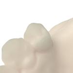 Elite Grade Opposite Jaw Model Resin Dental
