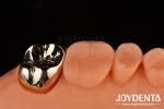 Dental Restoration Gold Metal Crowns for Oral Rehabilitation Treatment