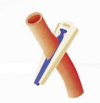 No Residue Alligaclip TM Absorbable Surgical Ligating Clips K12