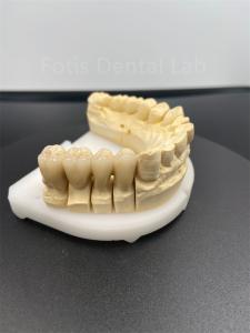 Quality Good Performance Dental Zirconia Multilayer The Ultimate Ceramic Solution wholesale