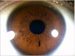 Green Iris Recognition Camera Iridology Device English Spanish Chinese
