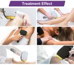 Professional Painless Lazer 808 nm Titanium Beauty Device Diode Laser Hair